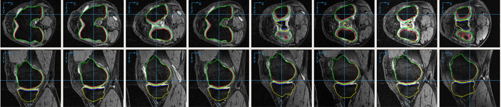 4D-knees-LOGISMOS-2.png