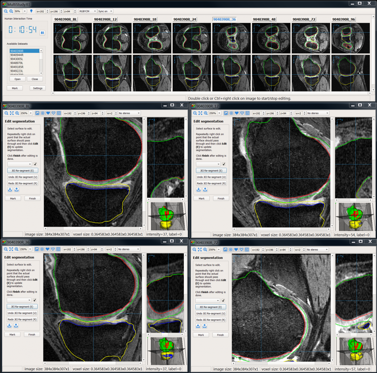 Orthopedic Image Analysis Iowa Institute for Biomedical Imaging The
