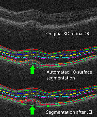 Retinal-OCT-10-surface-JEI+text.png