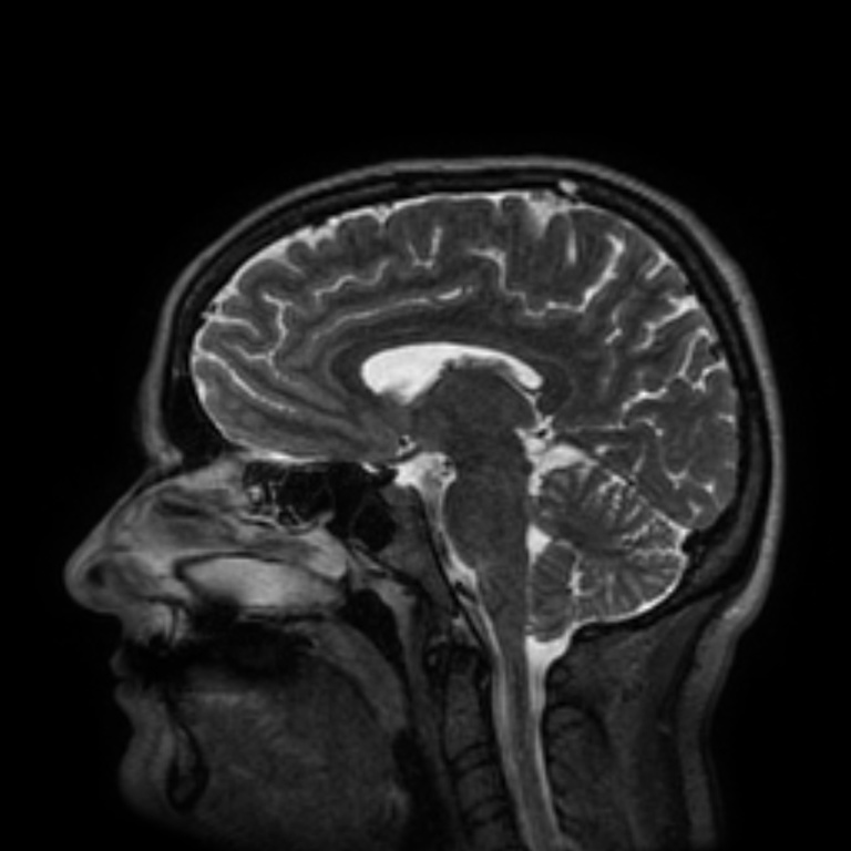 Brain scan