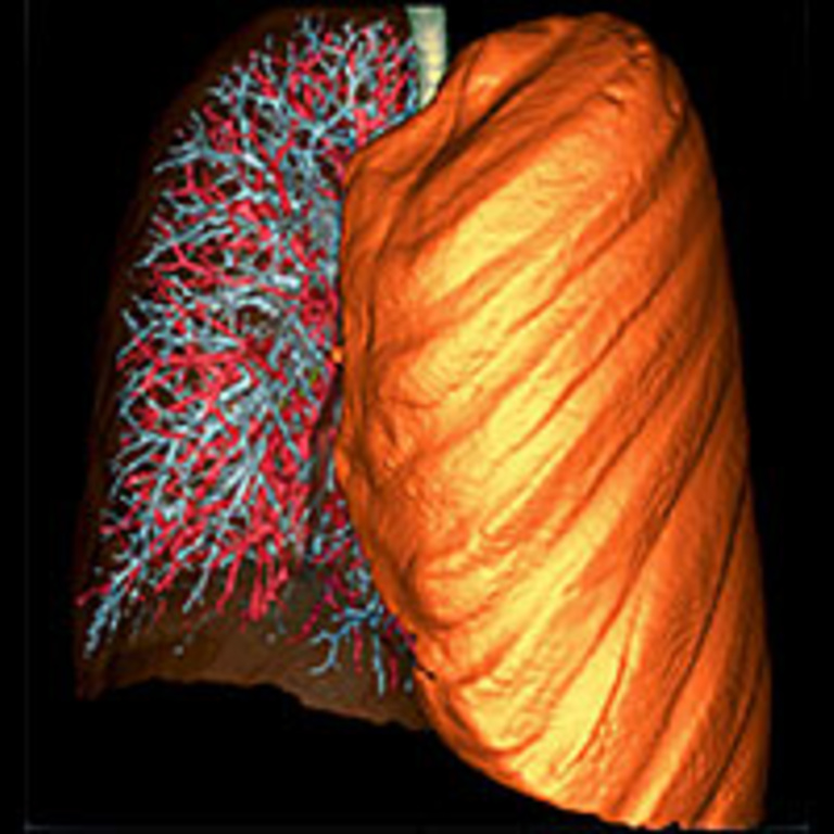 Lung
