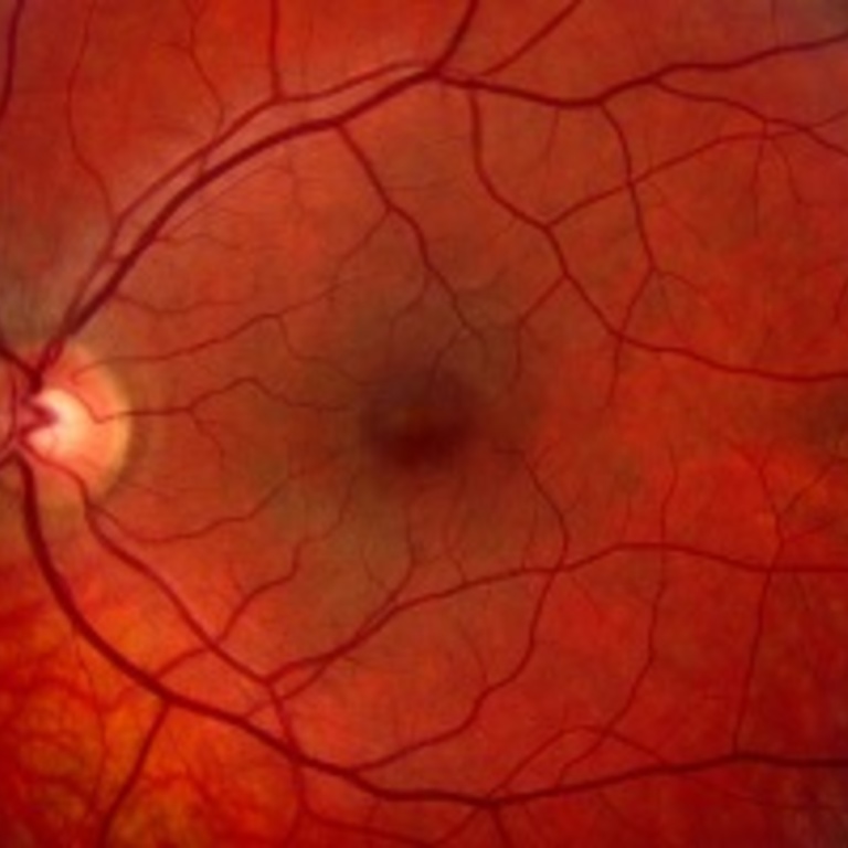 close up of inside the eyeball