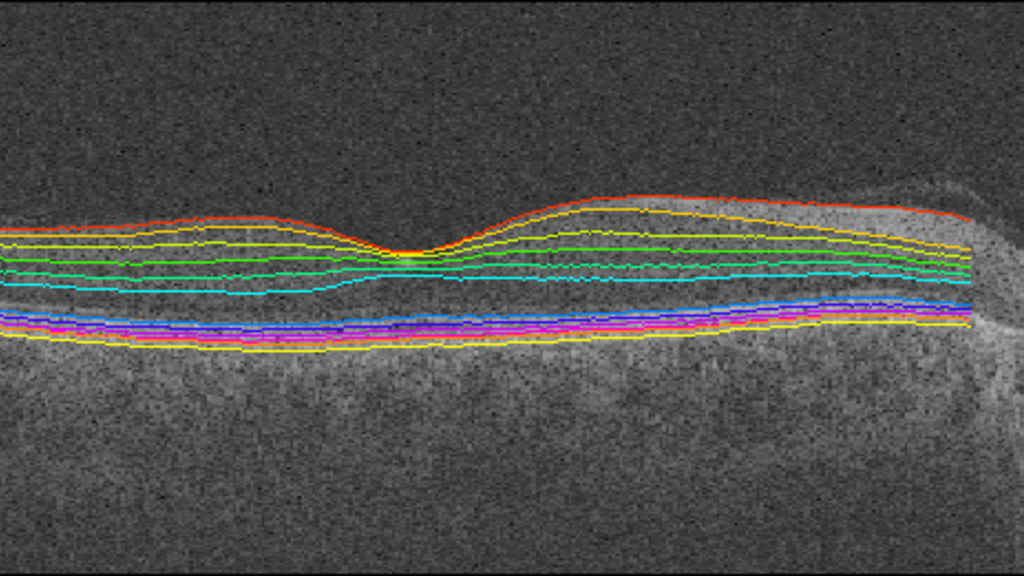 figure8oct.png